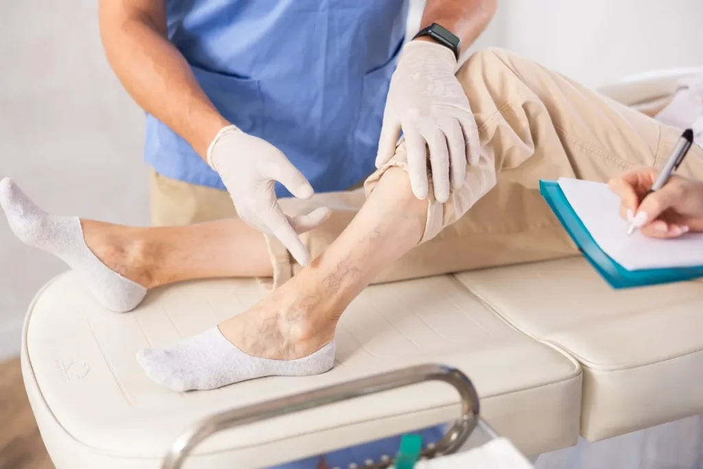 Leg Laser Vein Treatment Updated