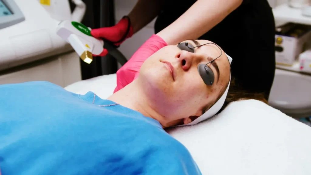 IPL Photofacial Treatment in Charlotte, NC at Infinity Medspa and Wellness