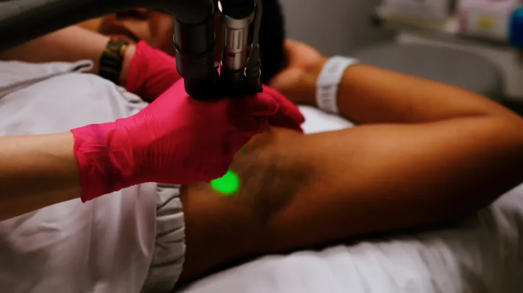 PicoSure® Focus Therapy in Charlotte, NC at Infinity Medspa and Wellness