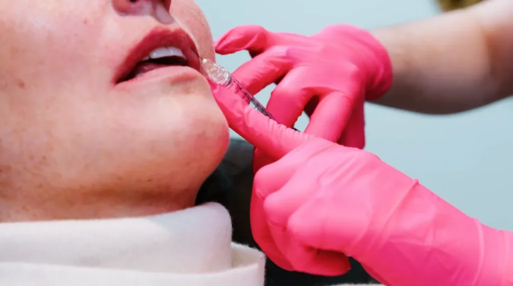 Fillers Treatment in Charlotte, NC at Infinity Medspa and Wellness