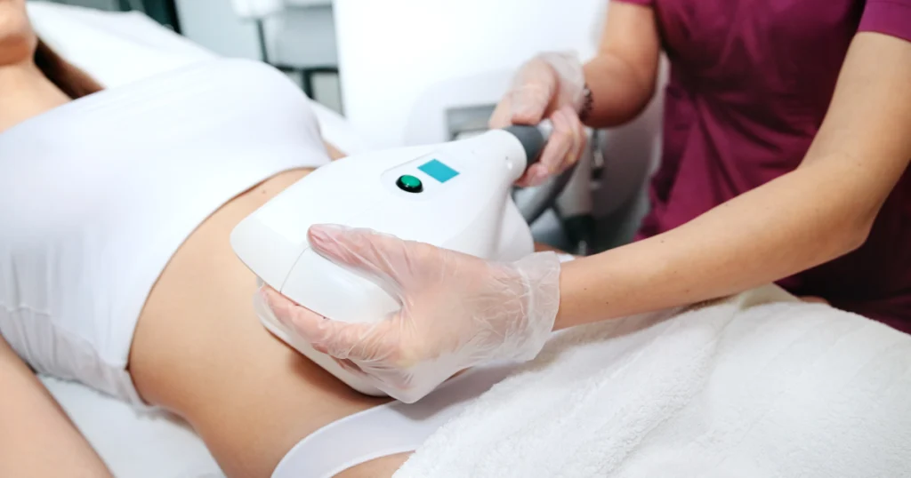 Women receiving Fat Reduction Treatment on her abdomen in Charlotte, NC