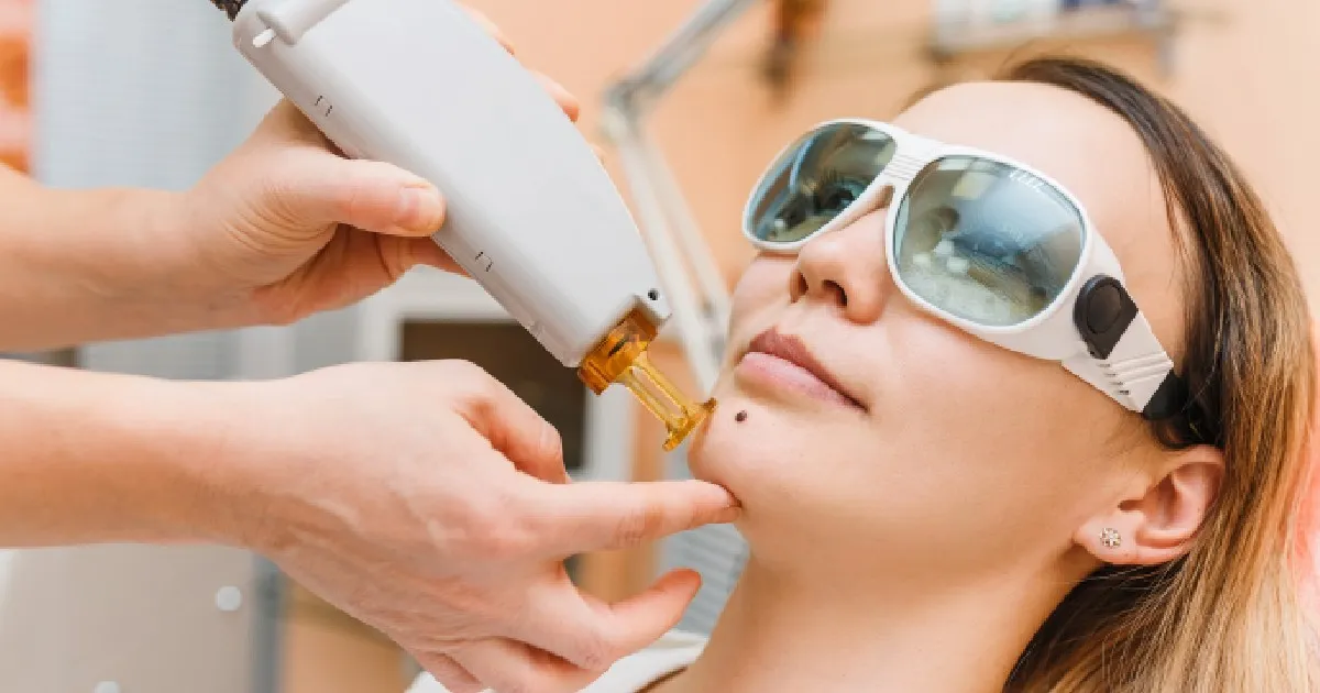 women receiving CoolPeel® Treatment in Charlotte