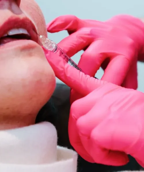 fillers